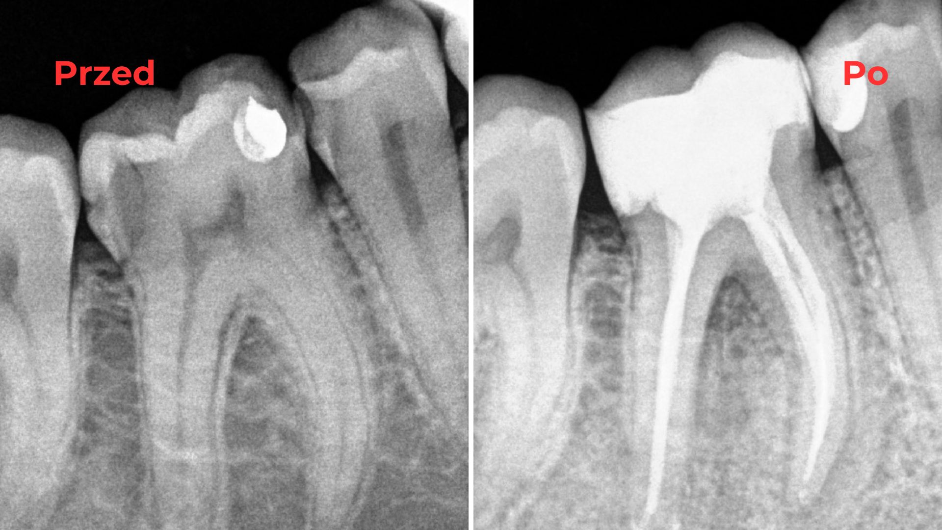 Endodoncja